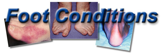 Foot Conditions 2 Track Foot Conditions 2 Track