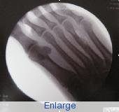 Picture 12