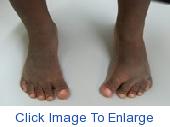 feet