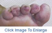 bluetoes