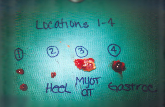 Figure 7 - All Lesions