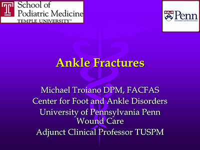 Ankle Fractures by Michael Troiano, DPM