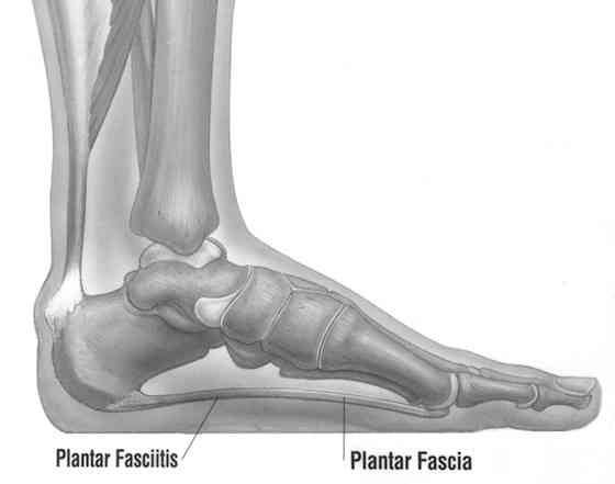 bpc 157 plantar fasciitis evidence BPC-157 for Injury Recovery and Gut Health: A Regenerative Peptide with Strong Potential BPC-157 for Plantar Fasciitis: Can